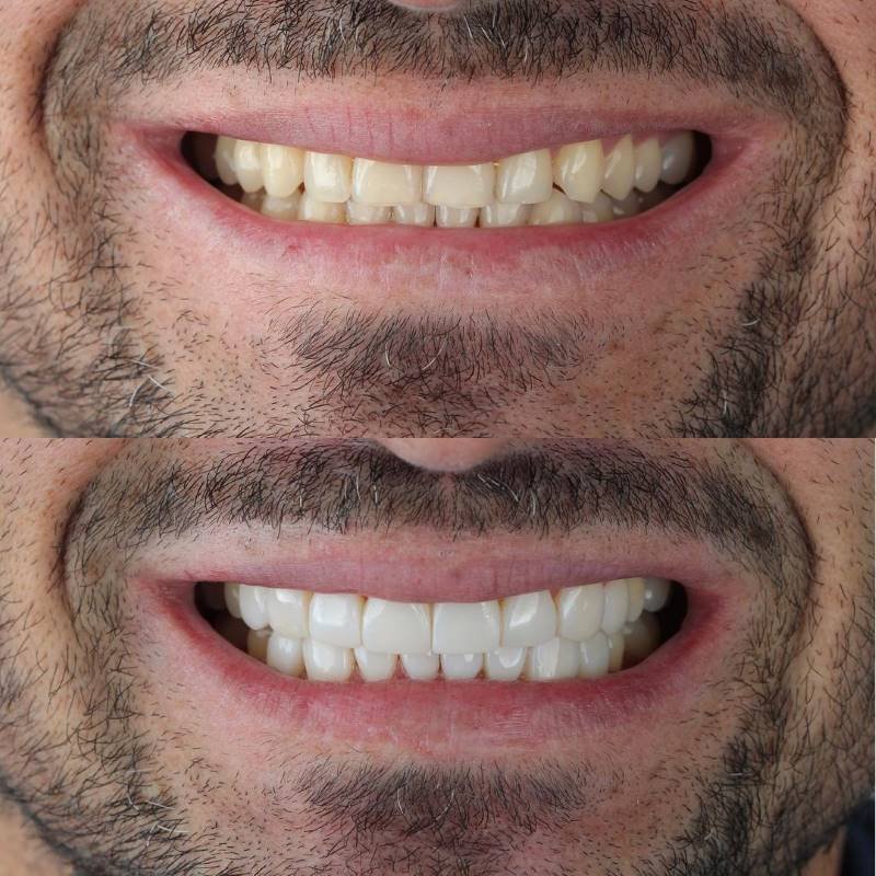 2 resultados daniel rivera odontologia cali