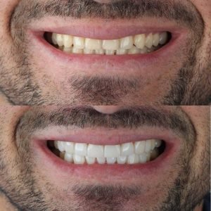 2 resultados daniel rivera odontologia cali