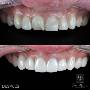 3 resultados daniel rivera odontologia cali