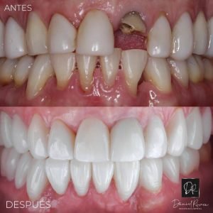 resultados daniel rivera odontologia cali
